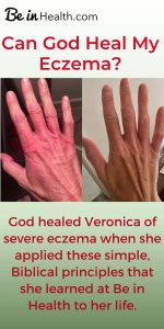 God healed Veronica’s eczema through the Biblical principles that she learned at Be in Health. Without any new remedies, medication, treatment, or diet. Find out how here!